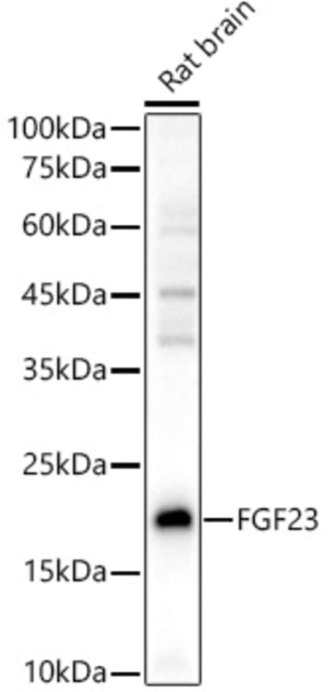 100UL FGF23 ANTIBODY 100 ul