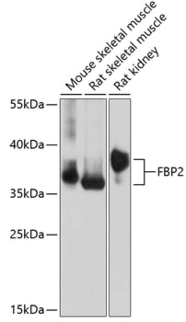 100UL FBP2 ANTIBODY 100 ul