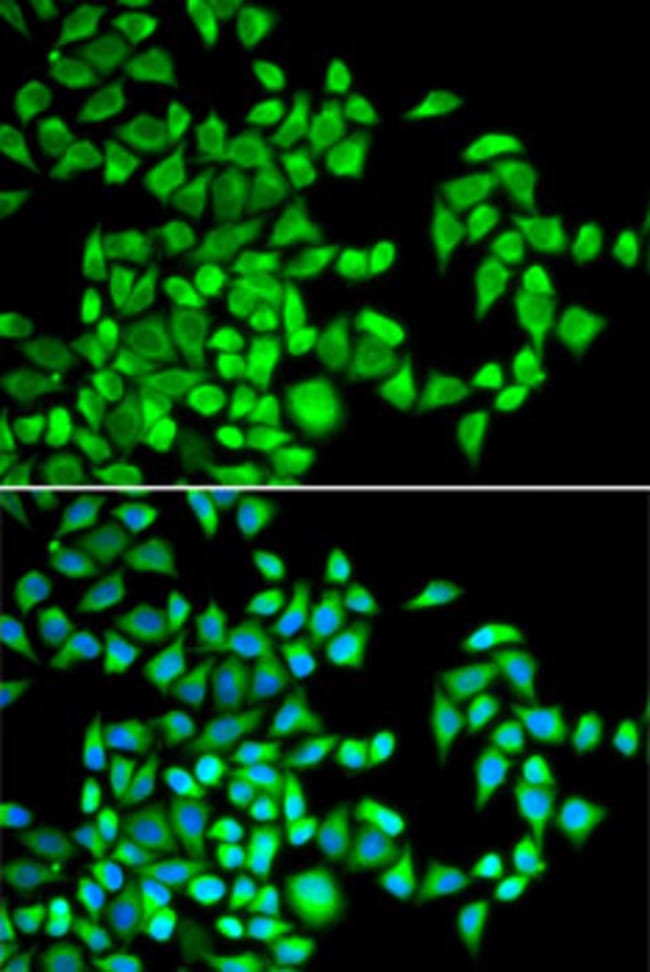 100UL ABH1 ANTIBODY 100 ul