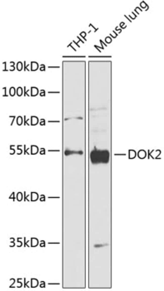 100UL DOK2 ANTIBODY 100 ul