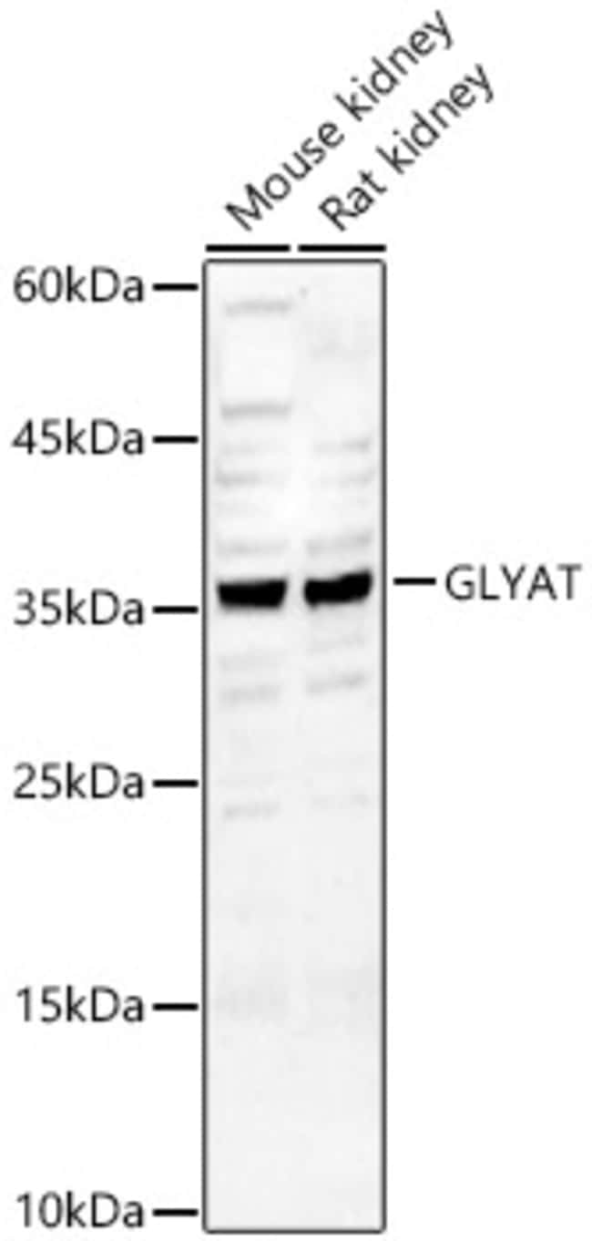 100UL GLYAT ANTIBODY 100 ul