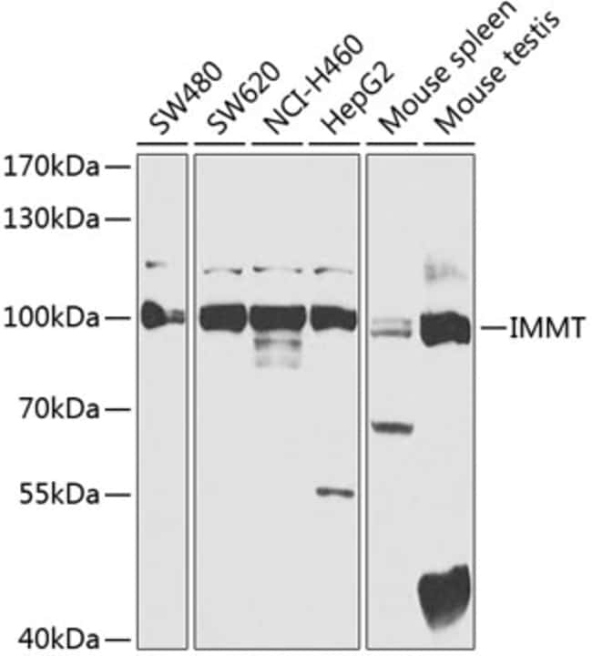 100UL MITOFILIN ANTIBODY 100 ul