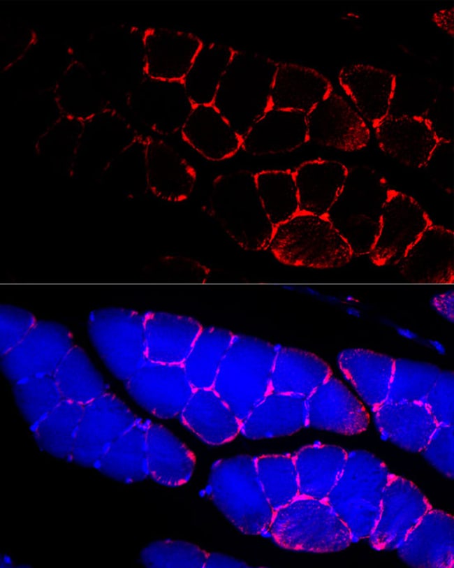 100UL DYSTROPHIN ANTIBODY 100 ul