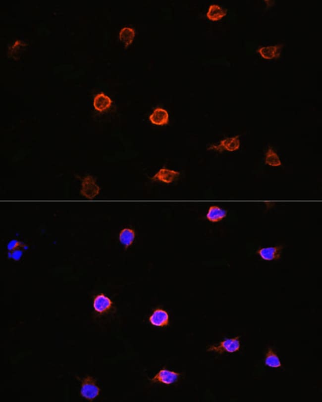 100UL AIPL1 ANTIBODY 100 ul