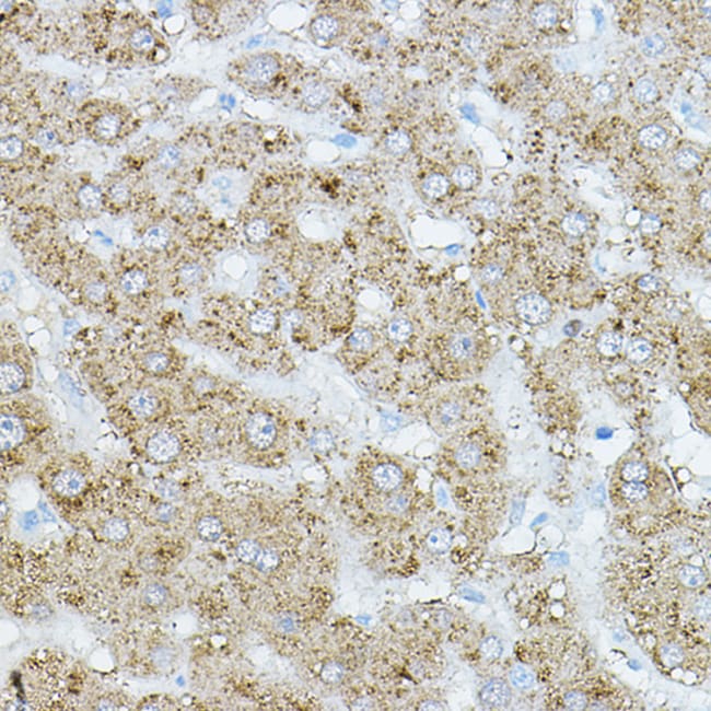 100UL HRI ANTIBODY 100 ul