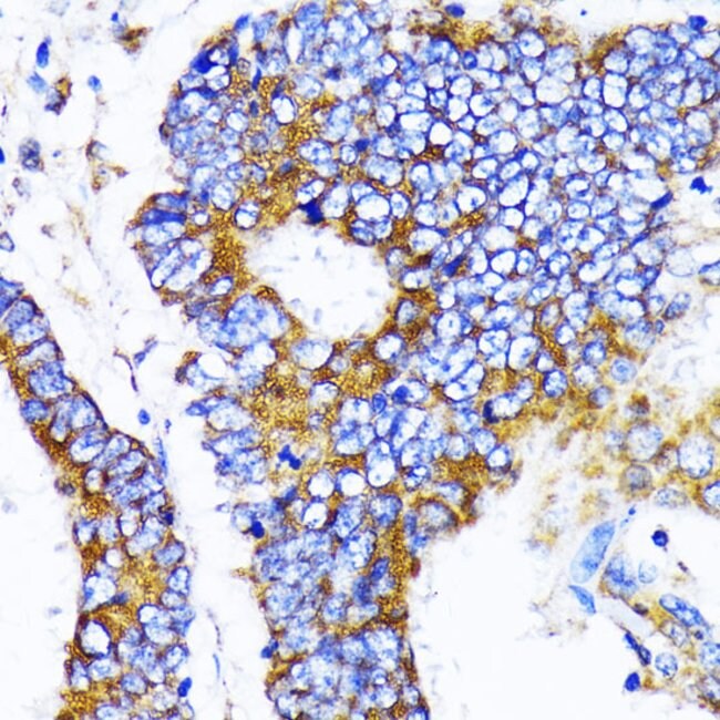 100UL MRPL13 ANTIBODY 100 ul