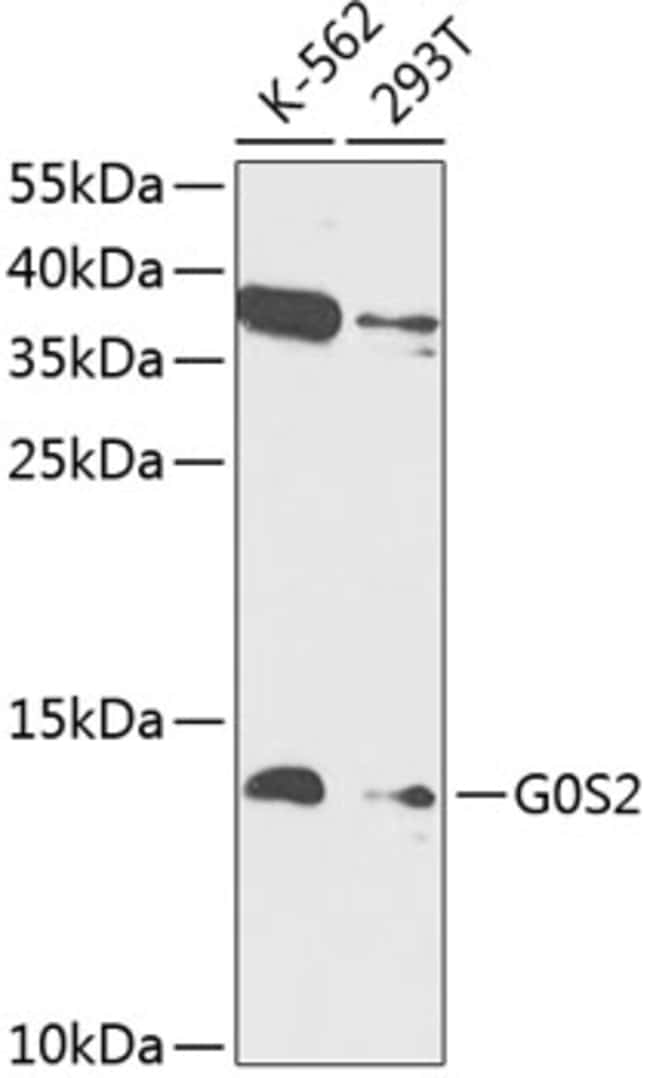 100UL G0S2 ANTIBODY 100 ul