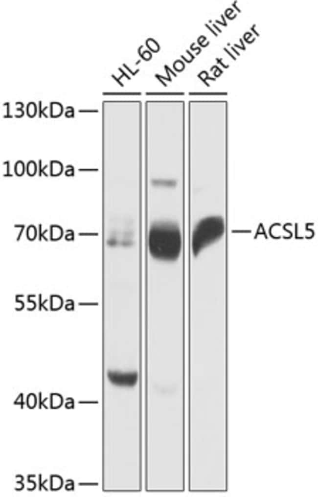 100UL ACSL5 ANTIBODY 100 ul