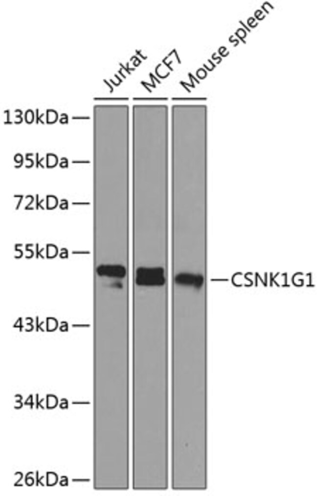 100UL CK1 GAMMA-1 ANTIBODY 100 ul