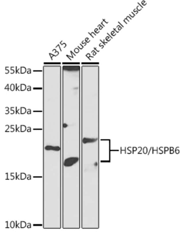 100UL HSP20 ANTIBODY 100 ul