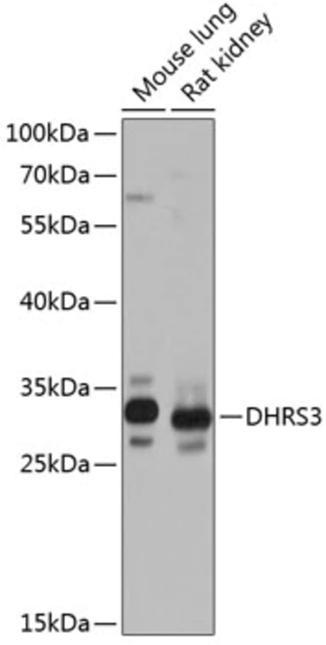 100UL DHRS3 ANTIBODY 100 ul