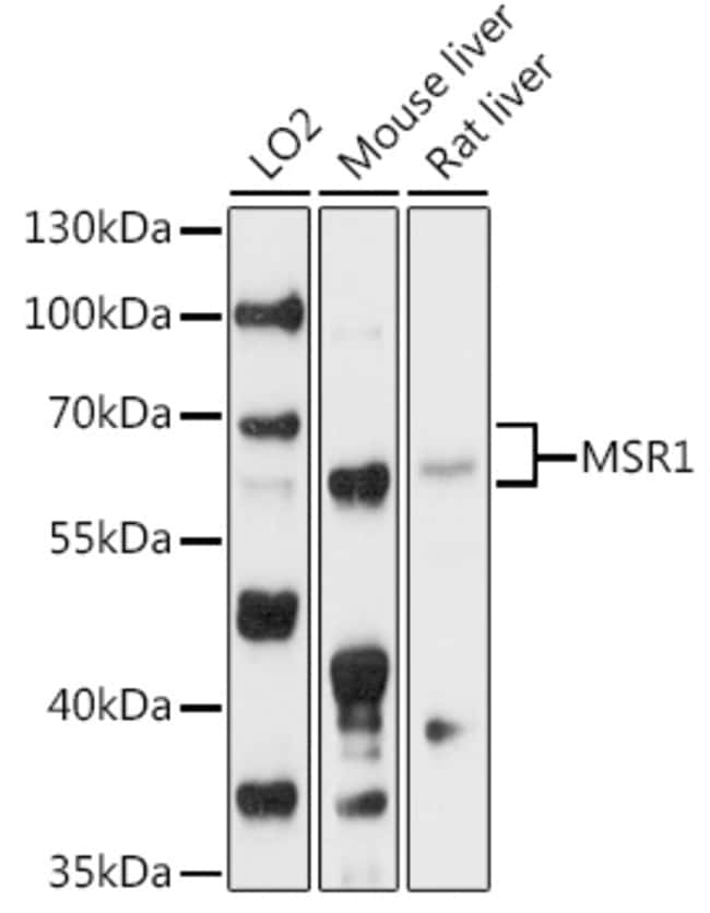 100UL CD204 ANTIBODY 100 ul