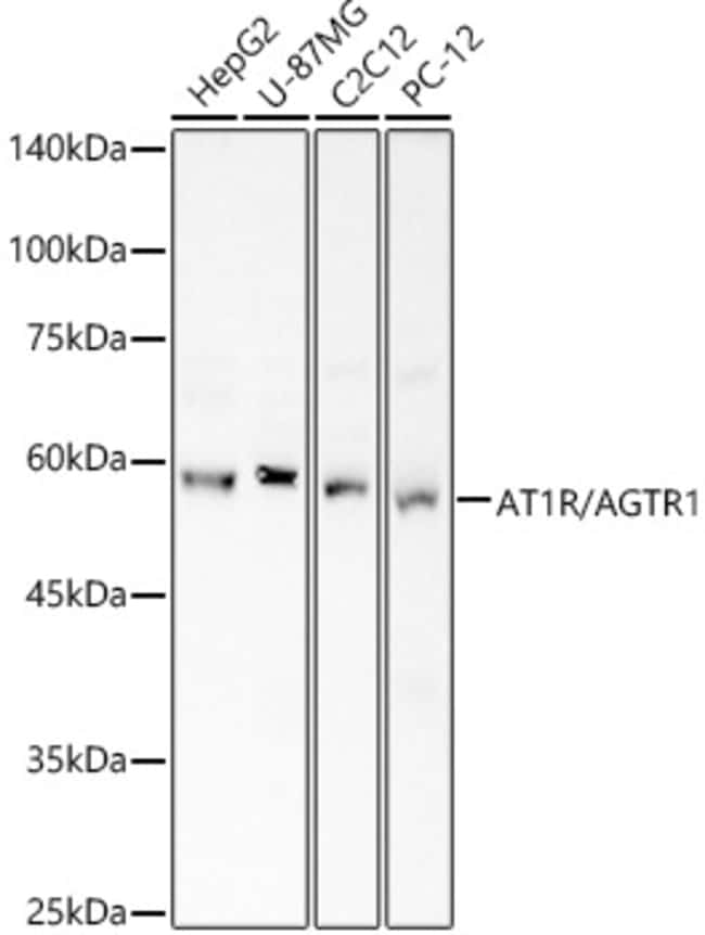 100UL AGTR1 ANTIBODY 100 ul