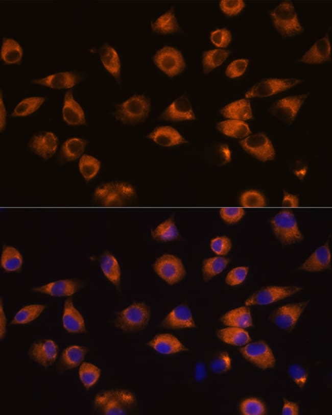100UL EPHA5 ANTIBODY 100 ul