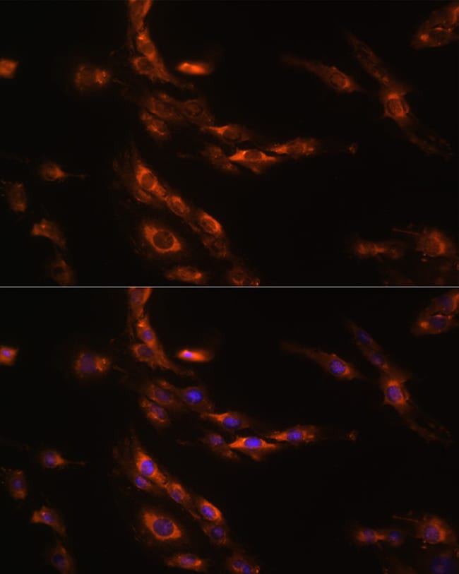 100UL GABRG1 ANTIBODY 100 ul