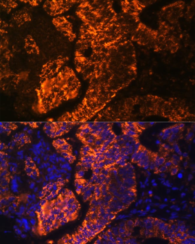 100UL DR3 ANTIBODY 100 ul