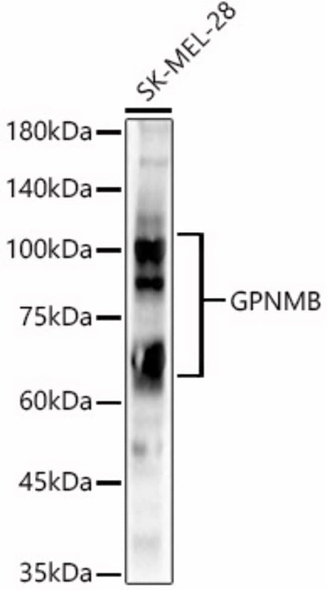 100UL GPNMB ANTIBODY 100 ul