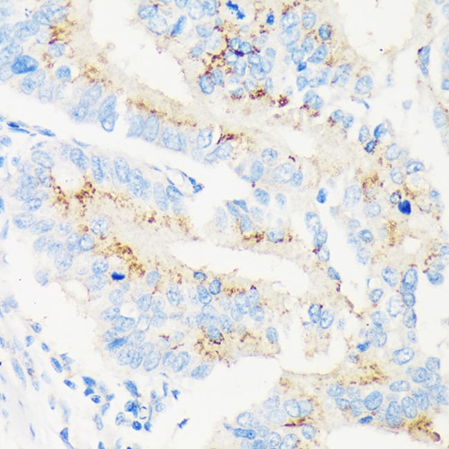 100UL MAN1A2 ANTIBODY 100 ul