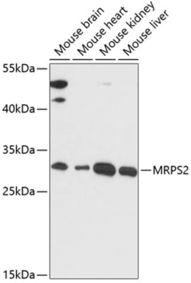 100UL MRPS2 ANTIBODY 100 ul