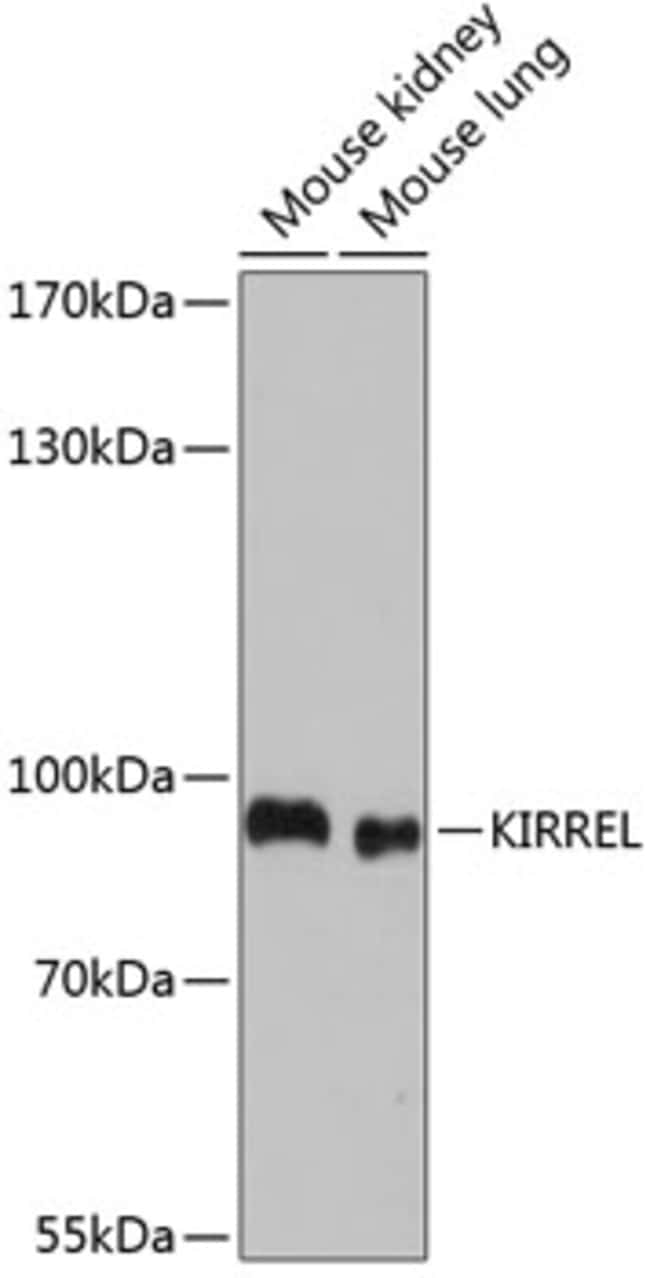 100UL KIRREL ANTIBODY 100 ul