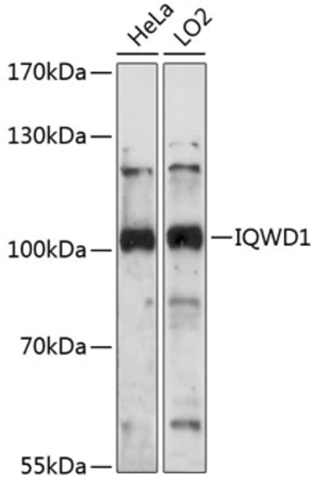 100UL DCAF6 ANTIBODY 100 ul