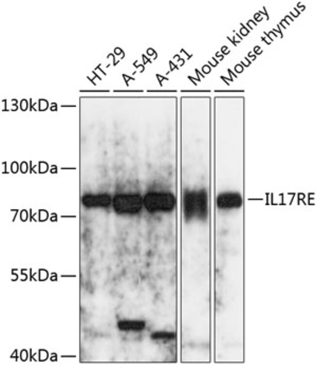 100UL IL17RE ANTIBODY 100 ul