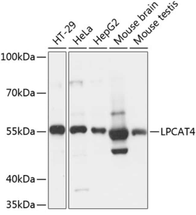 100UL LPCAT4 ANTIBODY 100 ul