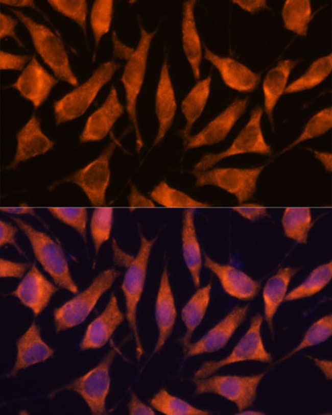100UL LHPP ANTIBODY 100 ul