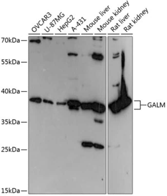 100UL GALM ANTIBODY 100 ul
