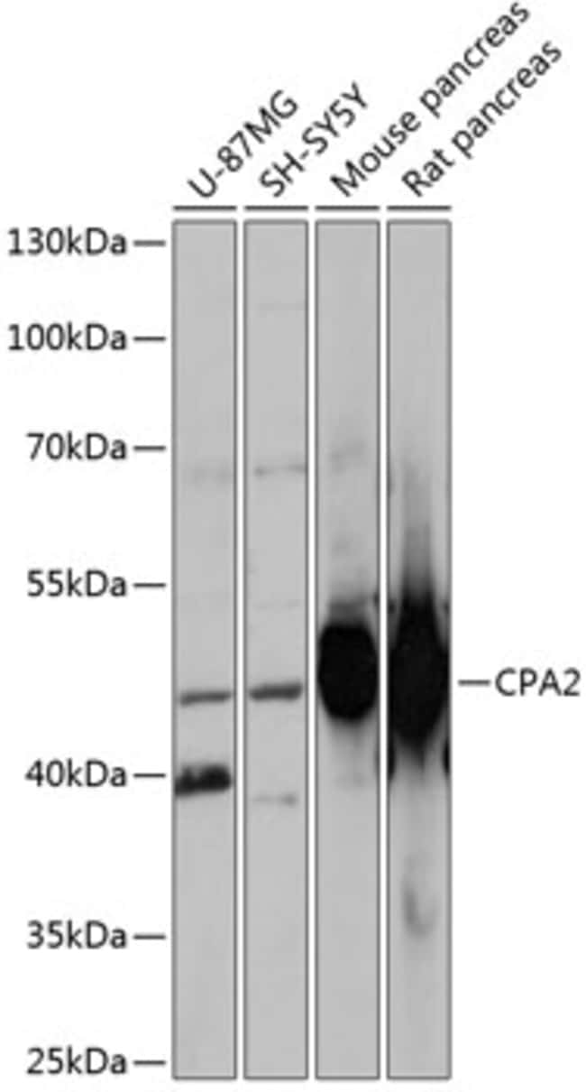 100UL CARBOXYPEPTIDASE A2 ANTIBODY 100 u