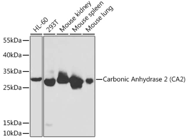 100UL CARBONIC ANHYDRASE II ANTIBODY 100