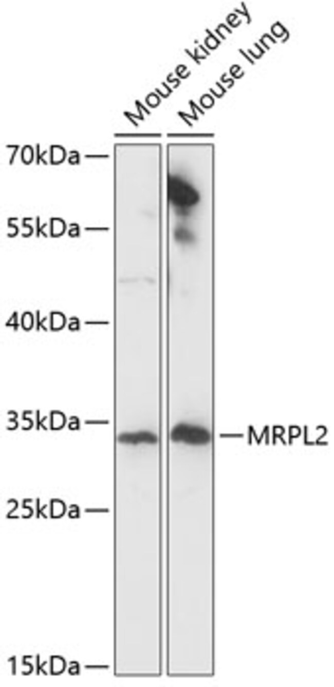 100UL MRPL2 ANTIBODY 100 ul