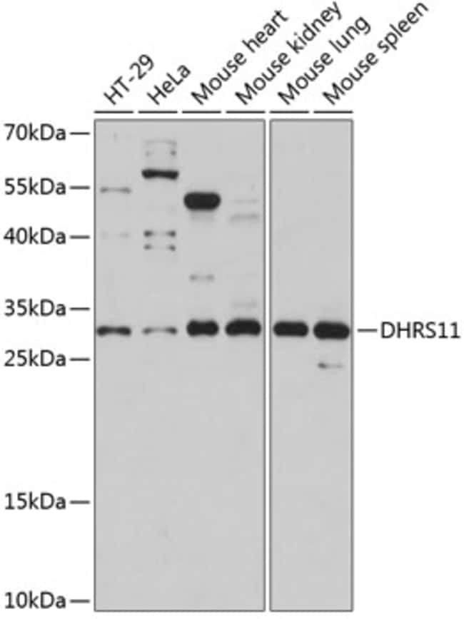 100UL DHRS11 ANTIBODY 100 ul