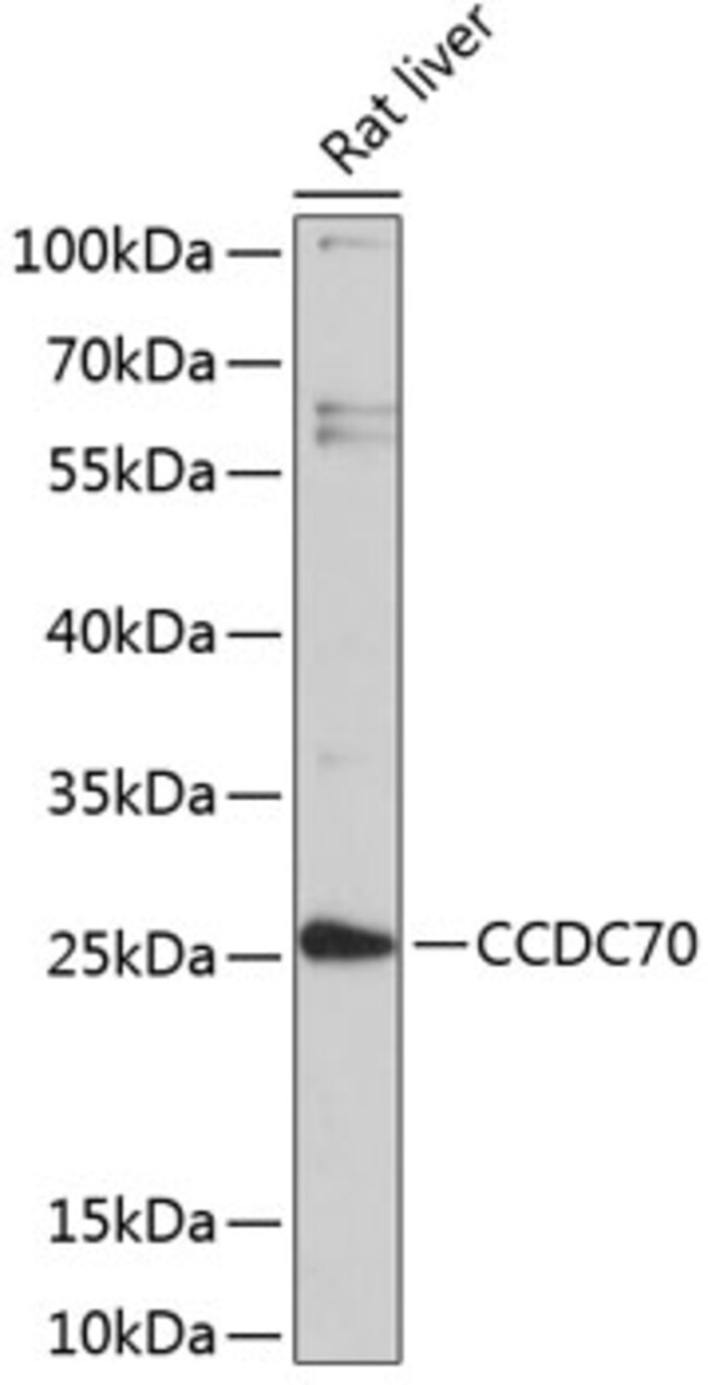 100UL CCDC70 ANTIBODY 100 ul