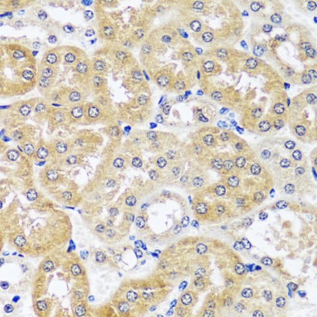 100UL CCDC124 ANTIBODY 100 ul