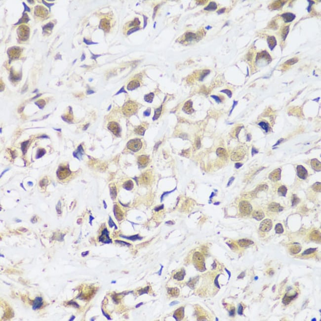 100UL ASCL4 ANTIBODY 100 ul
