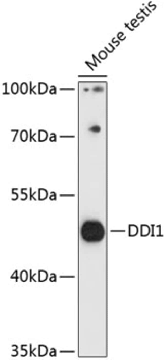 100UL DDI1 ANTIBODY 100 ul