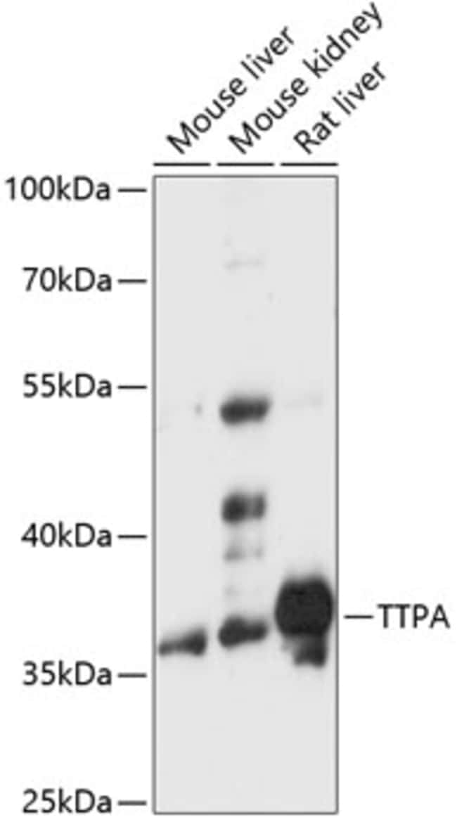 100UL ALPHA TTP ANTIBODY 100 ul