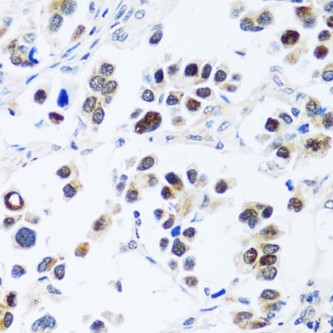 100UL BXDC2 ANTIBODY 100 ul