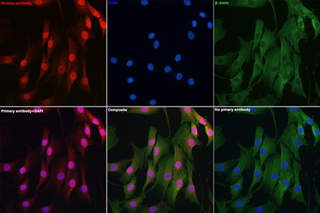 100UL DYNLL1 ANTIBODY 100 ul