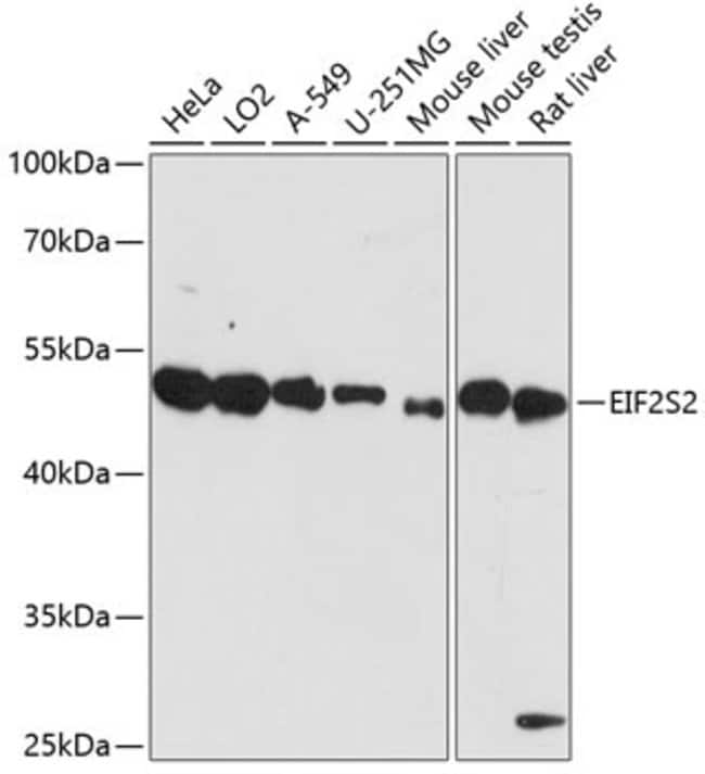 100UL EIF2 BETA ANTIBODY 100 ul