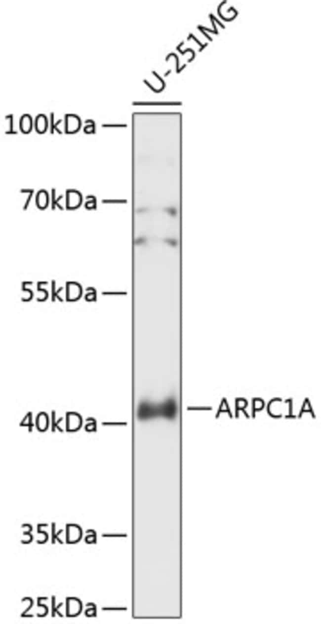 100UL ARPC1A ANTIBODY 100 ul
