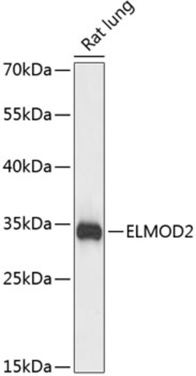 100UL ELMOD2 ANTIBODY 100 ul