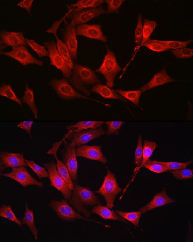 100UL GSS ANTIBODY 100 ul