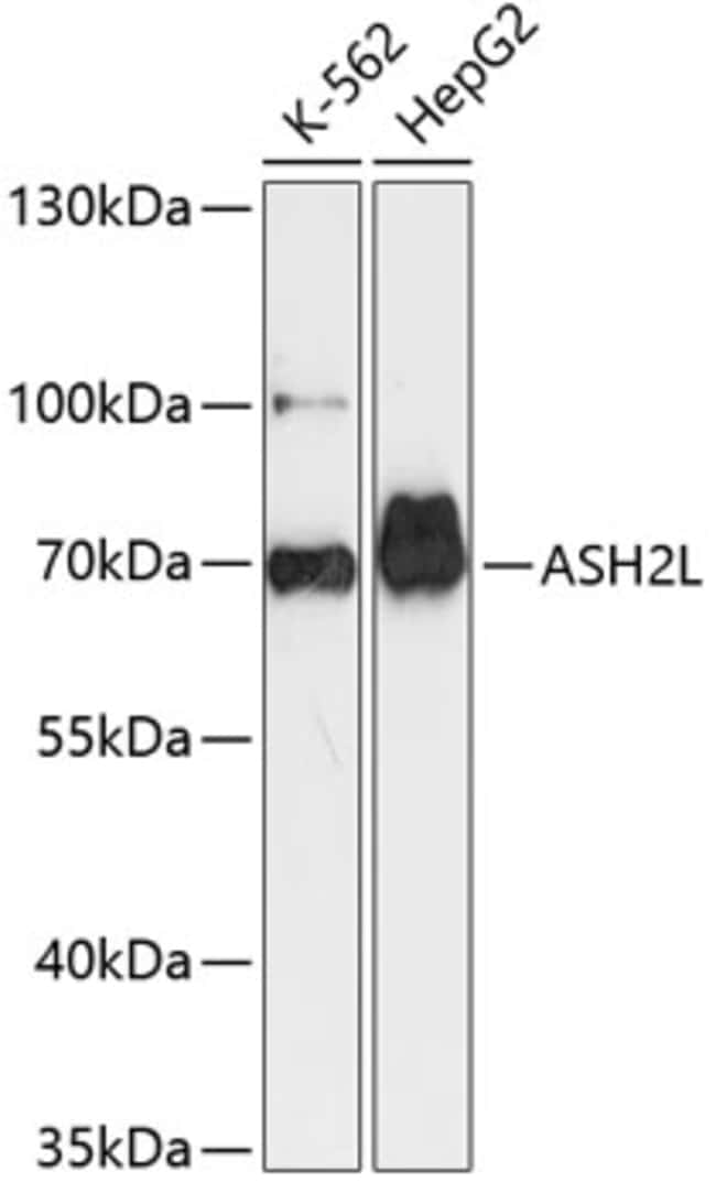 100UL ASH2L ANTIBODY 100 ul