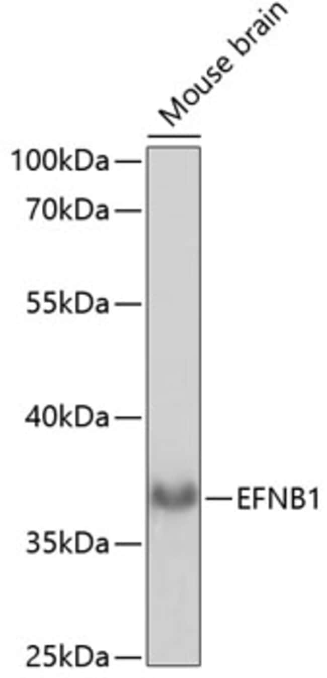 100UL EPHRIN B1 ANTIBODY 100 ul