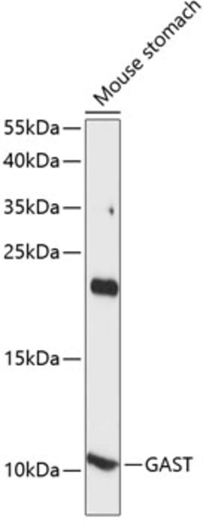 100UL GASTRIN ANTIBODY 100 ul