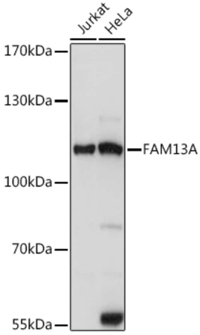 100UL FAM13A ANTIBODY 100 ul