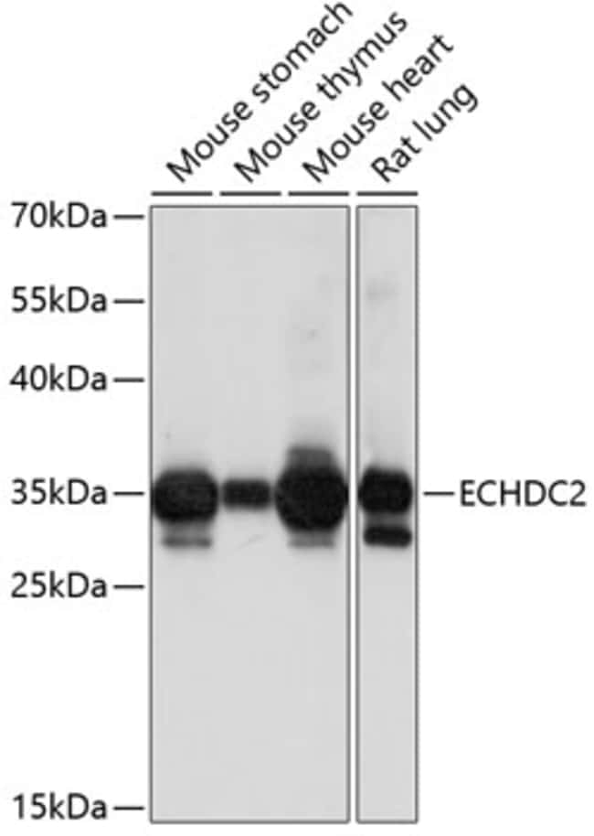 100UL ECHDC2 ANTIBODY 100 ul