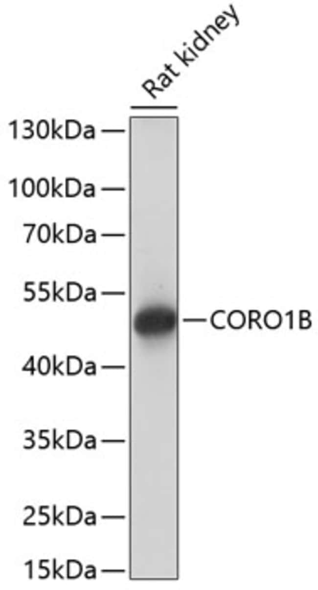 100UL CORONIN 1B ANTIBODY 100 ul